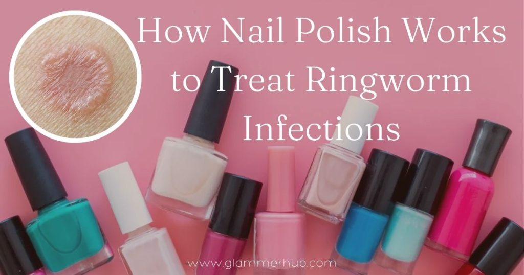 Nail Polish on Ringworm