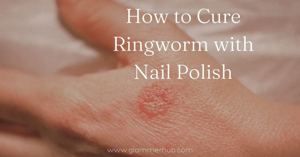 Nail Polish on Ringworm