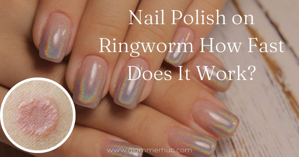 Nail Polish on Ringworm How Fast Does It Work